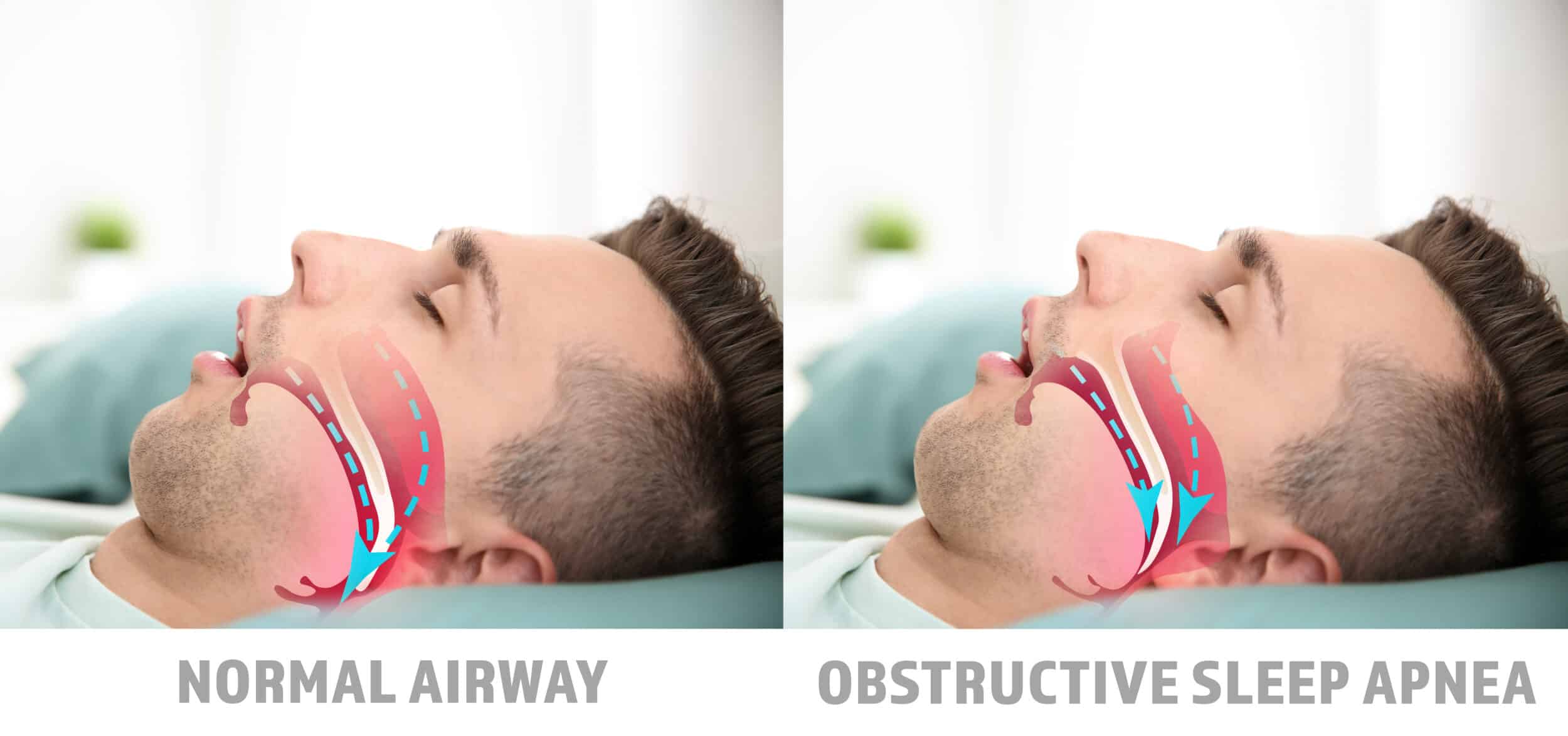 Sleep Apnea & Snoring Treatment Las Vegas NV