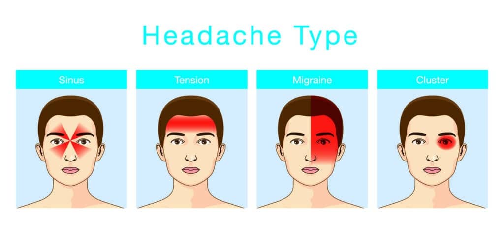 Types of headache