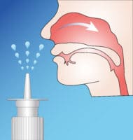 intranasal steroids for rhinitis and sinusitis