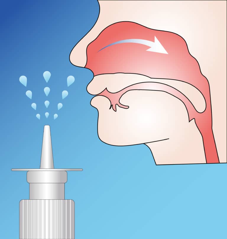 Use of intranasal steroids for rhinitis and sinusitis Nevada Sinus Relief