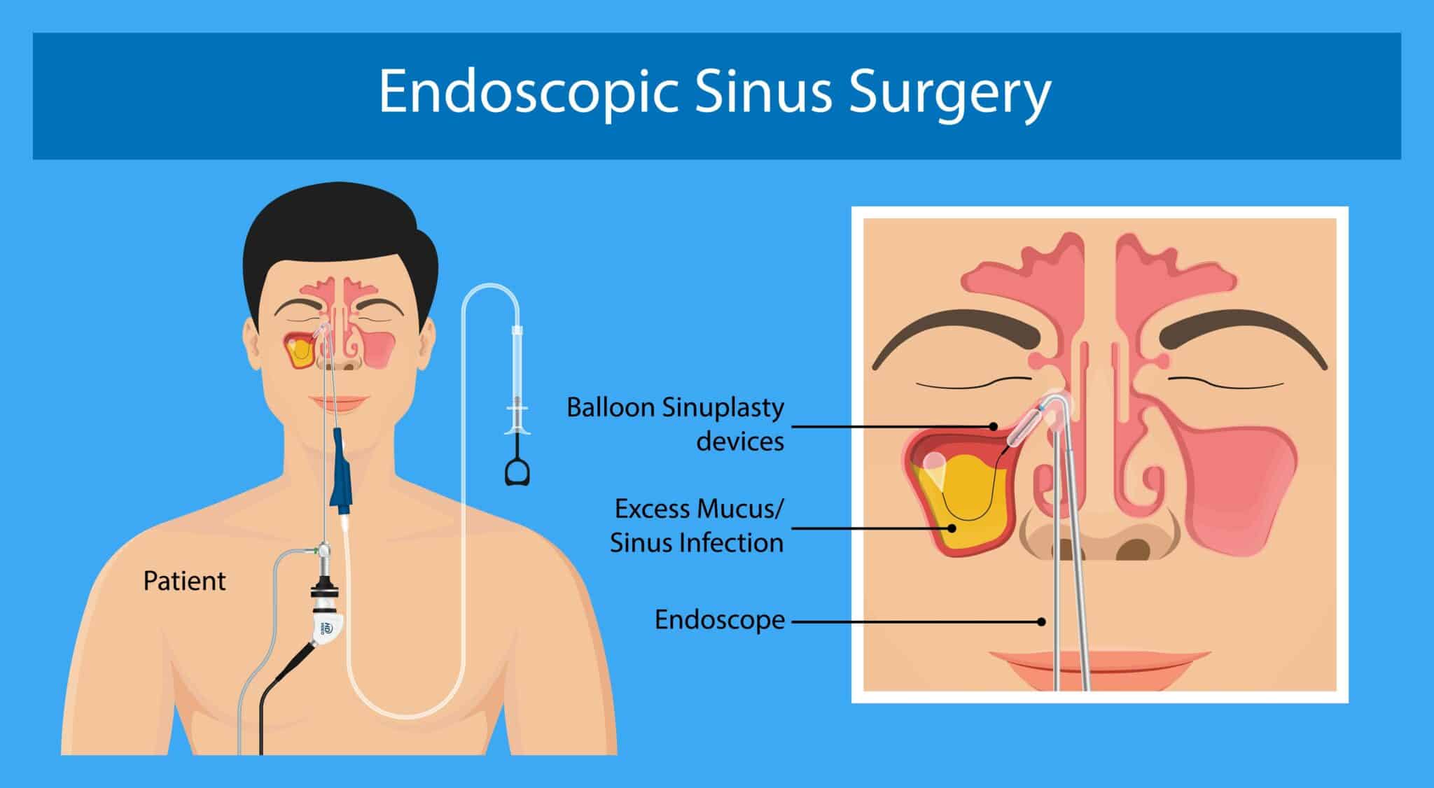 treatment-options-las-vegas-nv-sinus-treatment-las-vegas